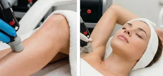 КОМПЛЕКТ: подмышки, бикини полностью и голени ( Обычная цена 272€)